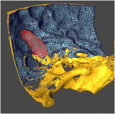 In Silico Assessment of Safety and Efficacy of Screw Placement for Pediatric Image-Guided Otologic Surgery